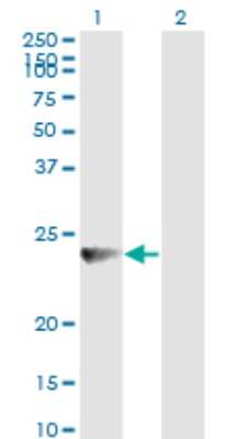 Western Blot: RAB7B Antibody (3B3) [H00338382-M01]