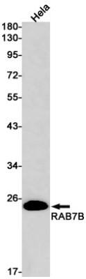 Western Blot: RAB7B Antibody (S08-2C5) [NBP3-19754]