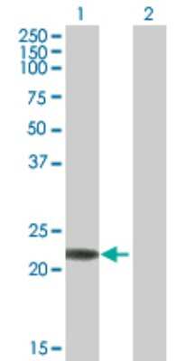 Western Blot: RAB7B Antibody [H00338382-B01P]