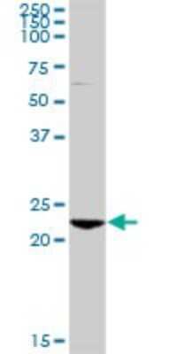 Western Blot: RAB7B Antibody [H00338382-D01P]