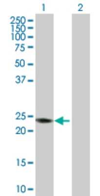 Western Blot: RAB7B Antibody [H00338382-D01P]