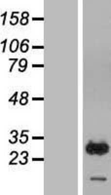 Western Blot: RAB7B Overexpression Lysate [NBL1-15088]