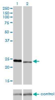 Western Blot: RAB7L1 Antibody (2B8) [H00008934-M03]