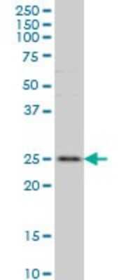 Western Blot: RAB7L1 Antibody (2B8) [H00008934-M03]