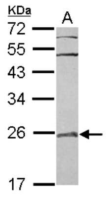 Western Blot: RAB7L1 Antibody [NBP2-20046]