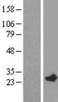 Western Blot: RAB7L1 Overexpression Lysate [NBP2-09576]