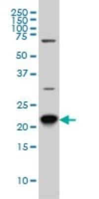 Western Blot: RAB8A Antibody (3G1) [H00004218-M02]