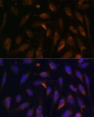 Immunocytochemistry/ Immunofluorescence: RAB8A Antibody - Azide and BSA Free [NBP3-04519]