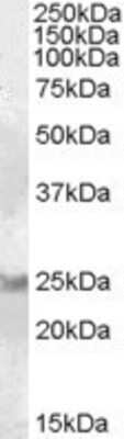 Western Blot: RAB8A Antibody [NB100-93433]