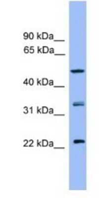 Western Blot: RAB8B Antibody [NBP1-69095]