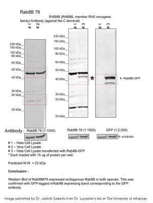 Western Blot: RAB8B Antibody [NBP1-69095]