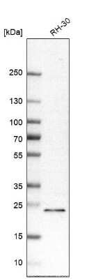 Western Blot: RAB8B Antibody [NBP2-57641]