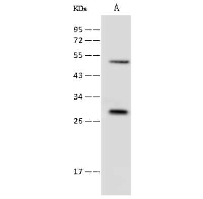 Western Blot: RAB8B Antibody [NBP2-99626]