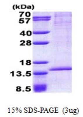 SDS-PAGE: Recombinant Human RAB8B His Protein [NBP2-23394]