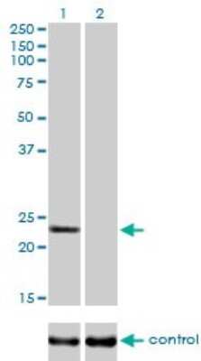 Western Blot: RAB9A Antibody (1E12) [H00009367-M01]