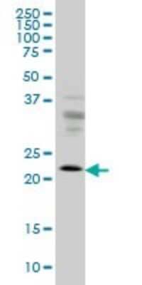 Western Blot: RAB9A Antibody (1E12) [H00009367-M01]