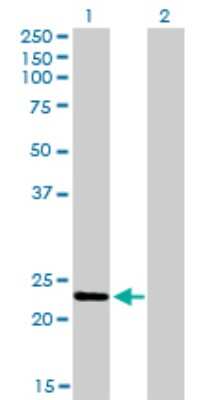 Western Blot: RAB9A Antibody (1E12) [H00009367-M01]