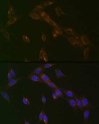 Immunocytochemistry/ Immunofluorescence: RAB9A Antibody (7O1G4) [NBP3-16506]