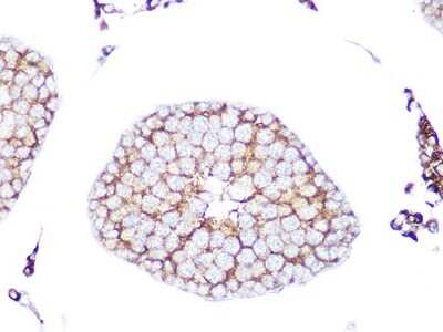 Immunohistochemistry-Paraffin: RAB9A Antibody (7O1G4) [NBP3-16506]