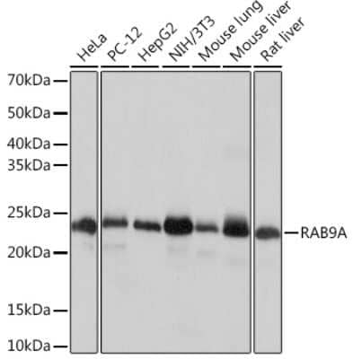 Western Blot: RAB9A Antibody (7O1G4) [NBP3-16506]