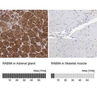 Immunohistochemistry-Paraffin: RAB9A Antibody [NBP1-87172]
