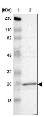 Western Blot: RAB9A Antibody [NBP1-87172]