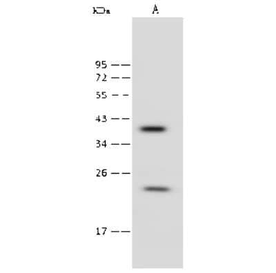 Western Blot: RAB9A Antibody [NBP2-99423]