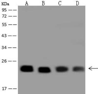 Western Blot: RAB9A Antibody [NBP3-12712]