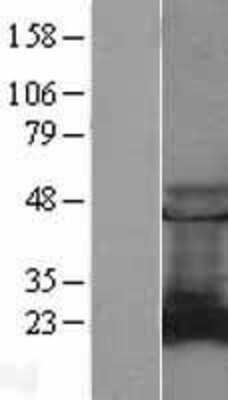 Western Blot: RAB9A Overexpression Lysate [NBL1-15092]