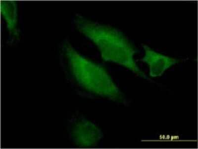 Immunocytochemistry/ Immunofluorescence: RAB9B Antibody (3C9) [H00051209-M04]