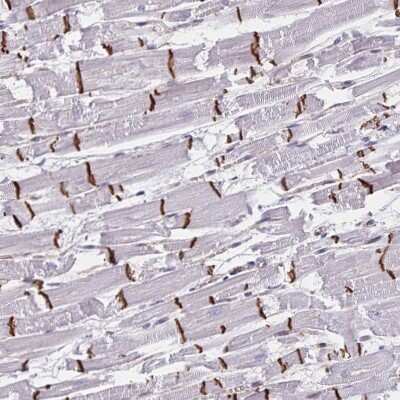Immunohistochemistry-Paraffin: RAB9B Antibody [NBP2-31854]