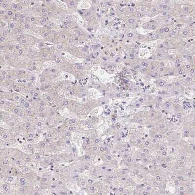 Immunohistochemistry-Paraffin: RAB9B Antibody [NBP2-31854]