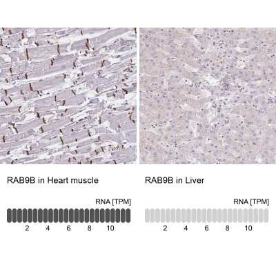 Immunohistochemistry-Paraffin: RAB9B Antibody [NBP2-31854]