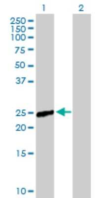 Western Blot: RAB9B Antibody [H00051209-B01P]