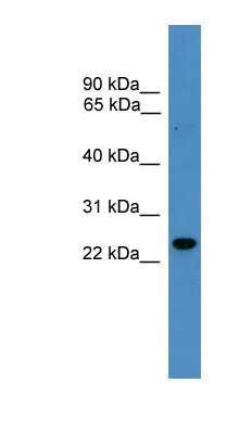 Western Blot: RAB9B Antibody [NBP1-79650]