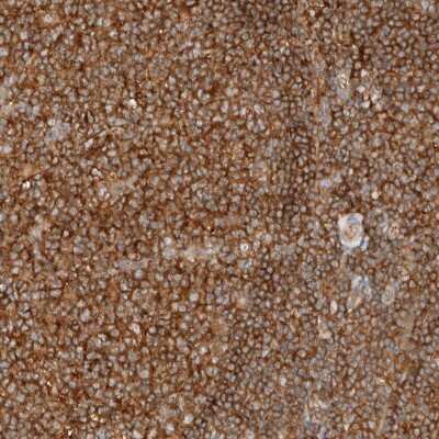 Immunohistochemistry-Paraffin: RABEP1 Antibody [NBP1-82588]