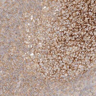 Immunohistochemistry-Paraffin: RABEP1 Antibody [NBP1-82589]