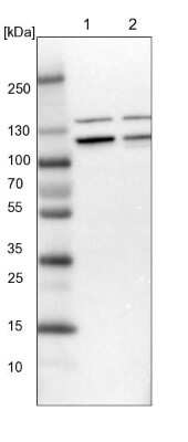 Western Blot: RABEP1 Antibody [NBP1-82588]