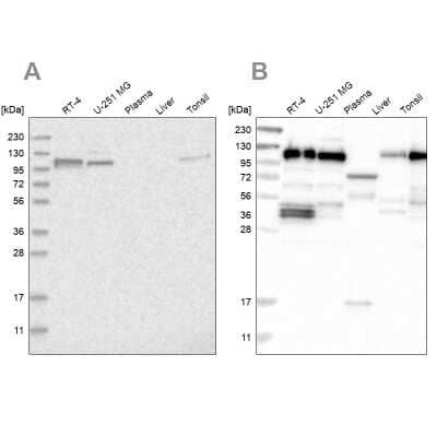 Western Blot: RABEP1 Antibody [NBP1-82588]