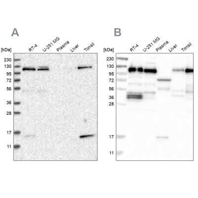 Western Blot: RABEP1 Antibody [NBP1-82589]