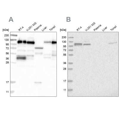 Western Blot: RABEP1 Antibody [NBP1-82590]