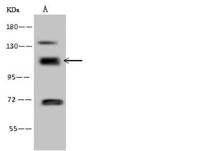 Western Blot: RABEP1 Antibody [NBP2-97637]