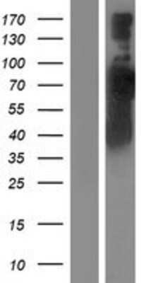 Western Blot: RABEP1 Overexpression Lysate [NBP2-07844]