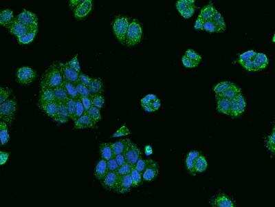 Immunocytochemistry/ Immunofluorescence: RABEP2 Antibody [NBP3-06404]