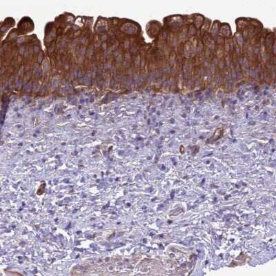 Immunohistochemistry-Paraffin: RABEP2 Antibody [NBP2-13195]