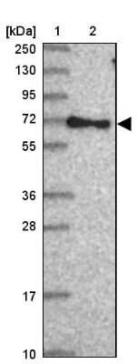 Western Blot: RABEP2 Antibody [NBP2-13195]