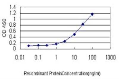 ELISA: RABGAP1 Antibody (1A8) [H00023637-M01]
