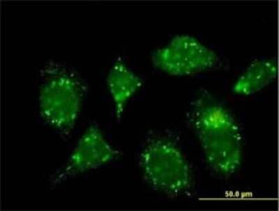 Immunocytochemistry/ Immunofluorescence: RABGAP1 Antibody (1A8) [H00023637-M01]