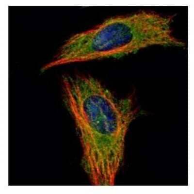 Immunocytochemistry/ Immunofluorescence: RABGAP1 Antibody [NBP2-15086]