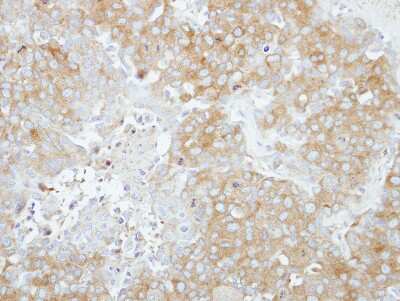 Immunohistochemistry-Paraffin: RABGAP1 Antibody [NBP2-15086]